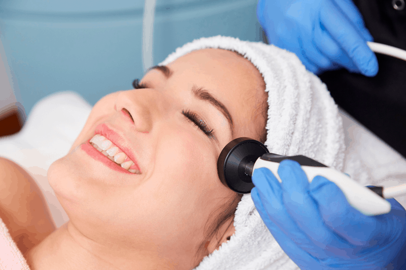 radiofrecuencia facial