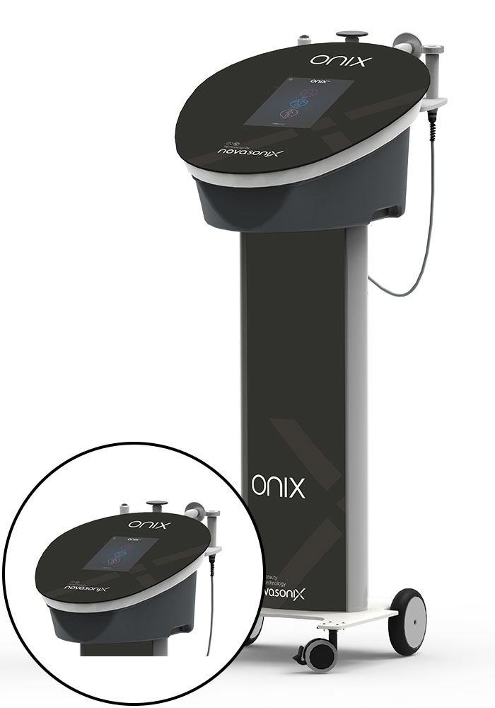 Radiofrecuencia corporal con el dispositivo ONIX Radiofrecuencia corporal con el dispositivo ONIX