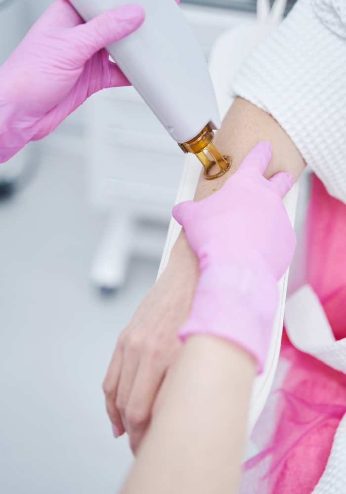 Recomendaciones para la depilación láser Alejandrita