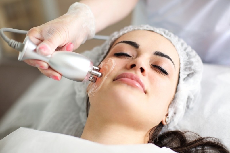 Beneficios del tratamiento de radiofrecuencia